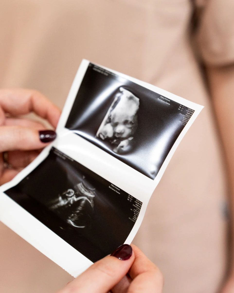 Ecografías emocionales