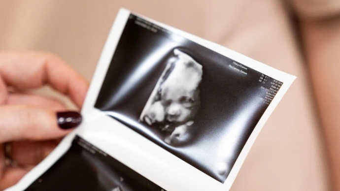 Ecografías emocionales